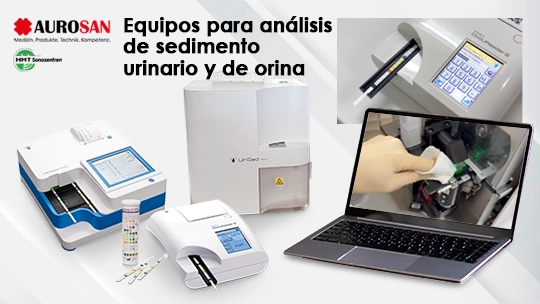 Sistemas de alto rendimiento para el análisis químico de la orina y el análisis de sedimentos